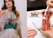 Luna Maya Bekukan Sel Telur di Umur 38 Tahun