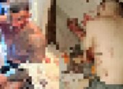 Serangan Gengster di Bali Tewaskan Turis Australia