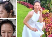 Sherly Chebing Menari dari Trauma: Kita Semua Berhak Bahagia