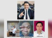 Buta Seumur Hidup Usai Operasi, PJI Desak Polda Jatim Bertindak Tegas