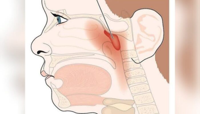 Hidung Ternyata Sistem Peringatan Dini Tubuh, Ini Risikonya Jika Rusak