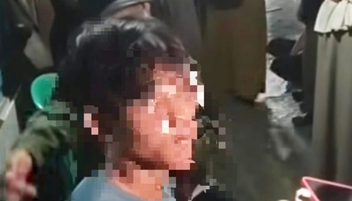 Fatur Ungkap Massa Masuk Gang dan Menyeretnya Saat Kericuhan Pejompongan Jakarta Pusat